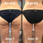 Masseur anti-cellulite skin